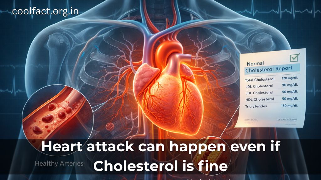 Heart attack can happen even if cholesterol is fine